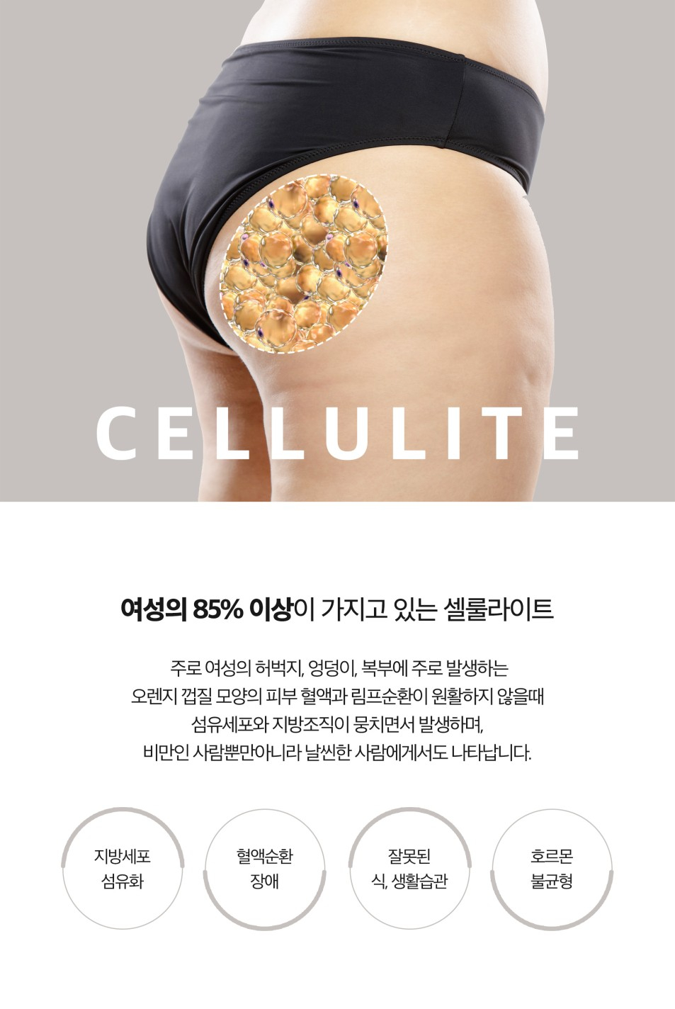 셀룰라이트토닝으로 피부 탄력 증가 관련 이미지 2