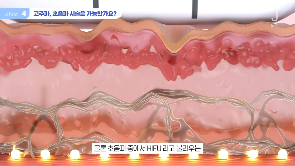임산부피부과 시술 가능한가요? Q&A 관련 이미지 13