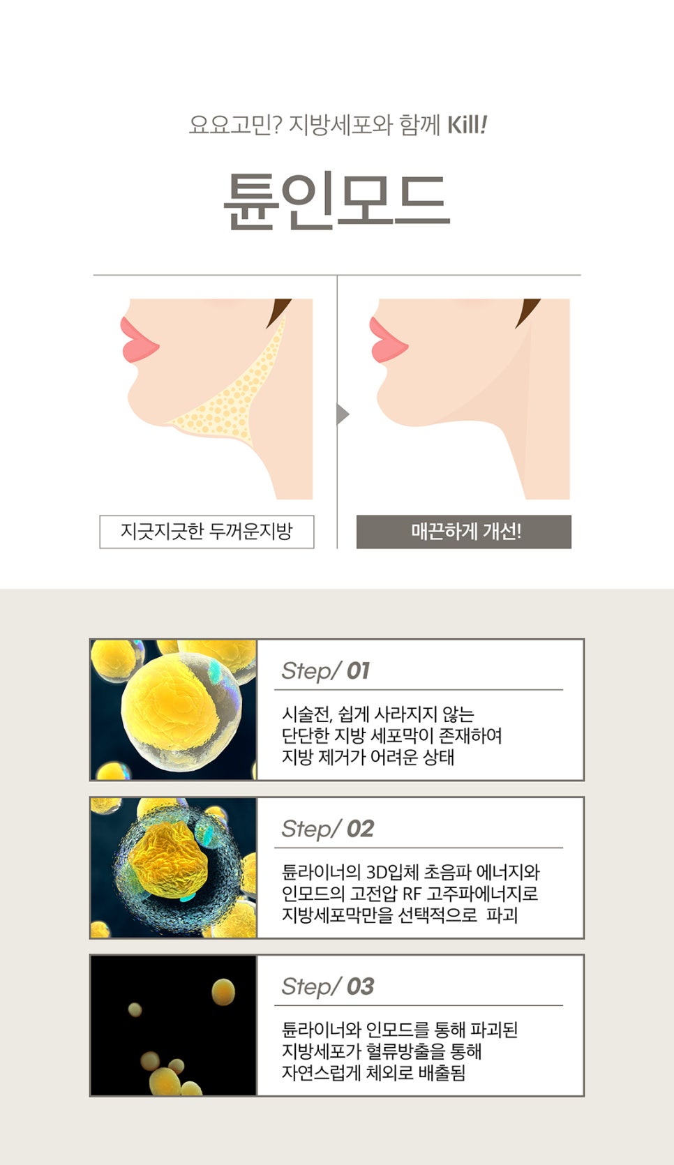 V라인만들기는 확실하게 튠인모드로 관련 이미지 3