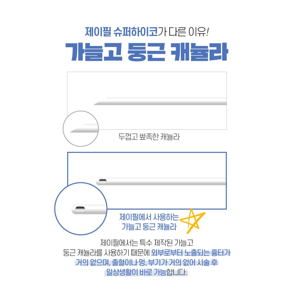 슈퍼하이코 코필러로 낮은코, 매부리코를 날카롭게! 관련 이미지 3
