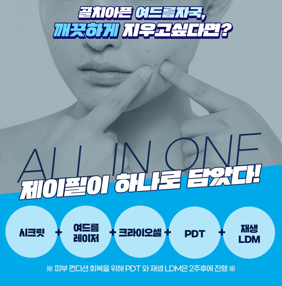여드름자국, 올인원으로 한 번에 해결하자 관련 이미지 2