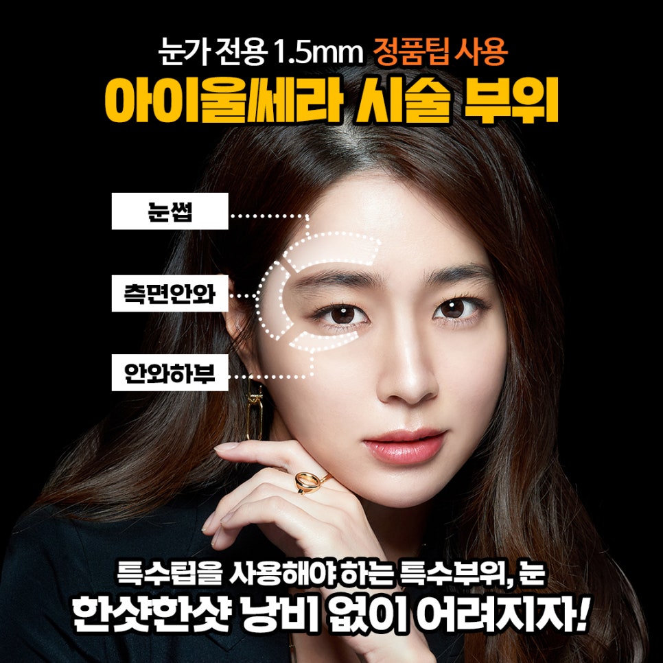 처진 눈가, 눈밑지방을 비수술하안검으로 또렷하고 선명하게 관련 이미지 3