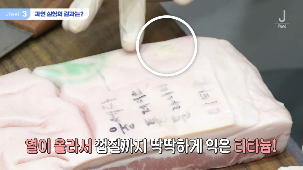 지방레이저가 얼굴 지방을 얼마나 녹일 수 있을까? 관련 이미지 6