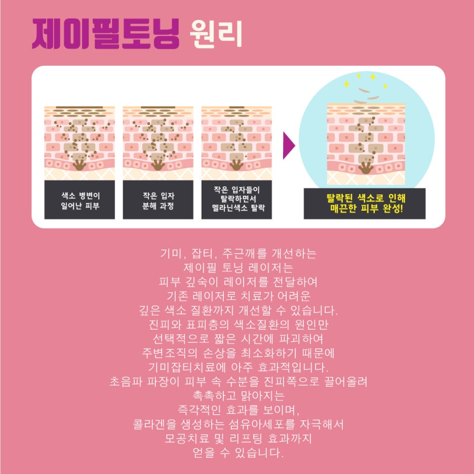 [홍대피부과] 제이필 레이저토닝-기미잡티제거는 제이필토닝으로 고민 해결! 관련 이미지 3