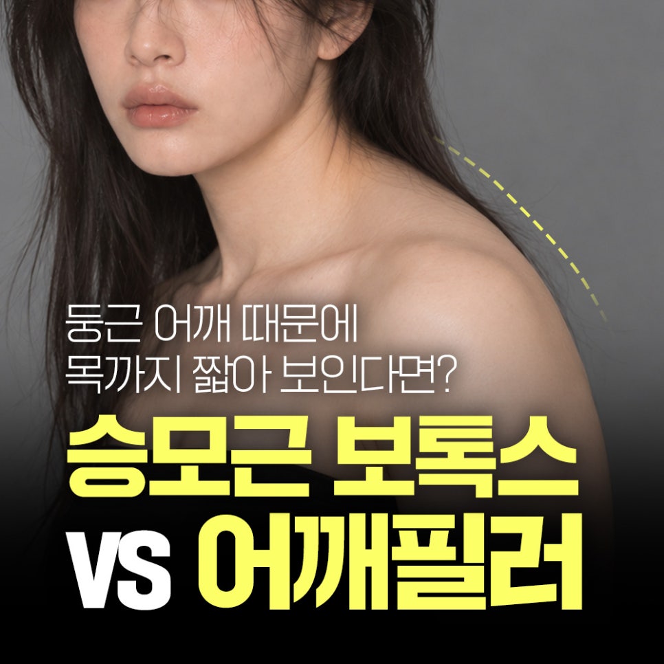 직각어깨 만드는 법, 승모근 보톡스 맞아도 안 되는 이유 관련 이미지 1