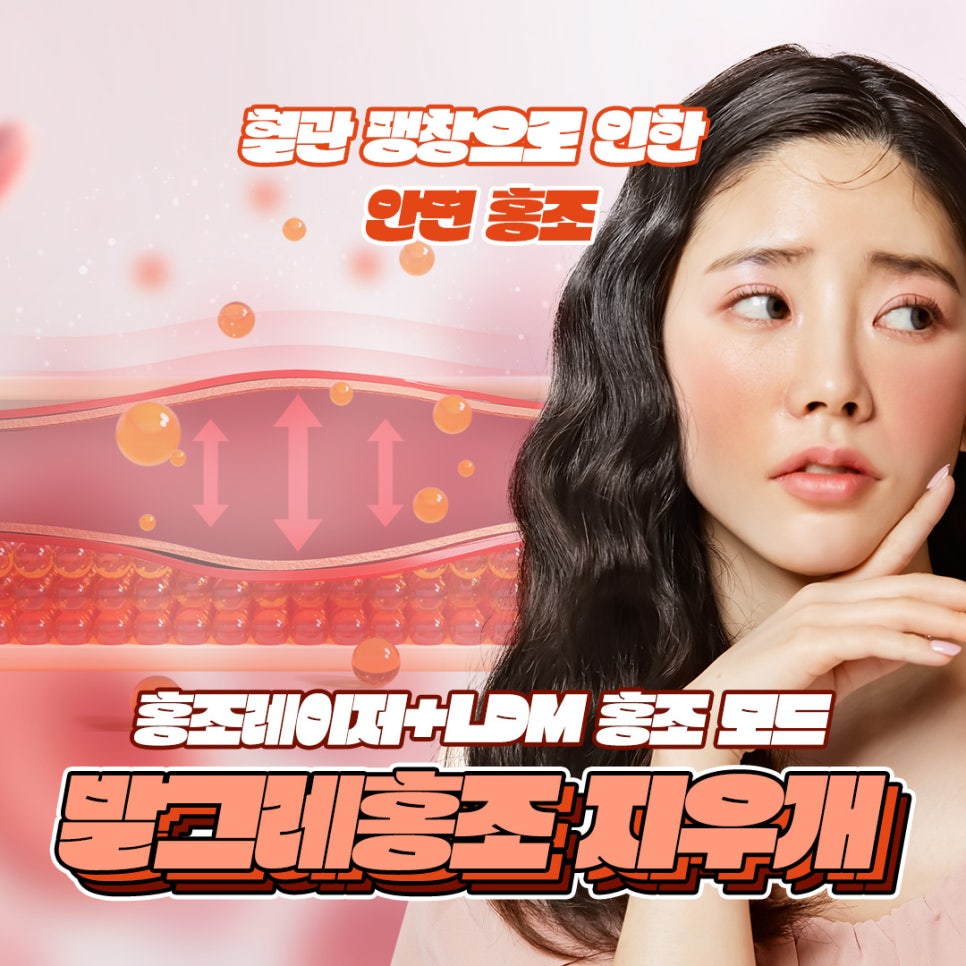 홍조피부과에서 발그레한 홍조 없애고 만족 관련 이미지 1