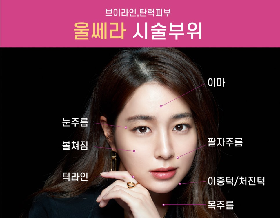 인모드,울쎄라를 이용한 리프팅 시술시 효과와 주의사항 관련 이미지 11