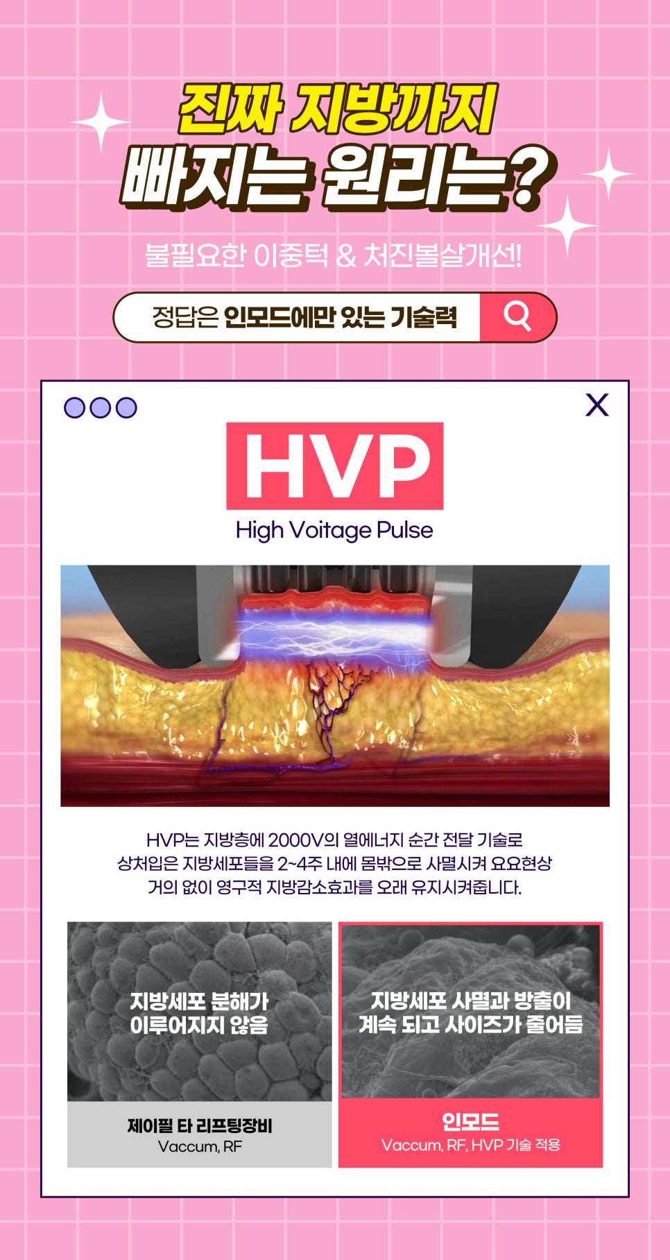 이중턱살제거 지방흡입없이 인모드꿀조합으로 갸름하게 관련 이미지 4