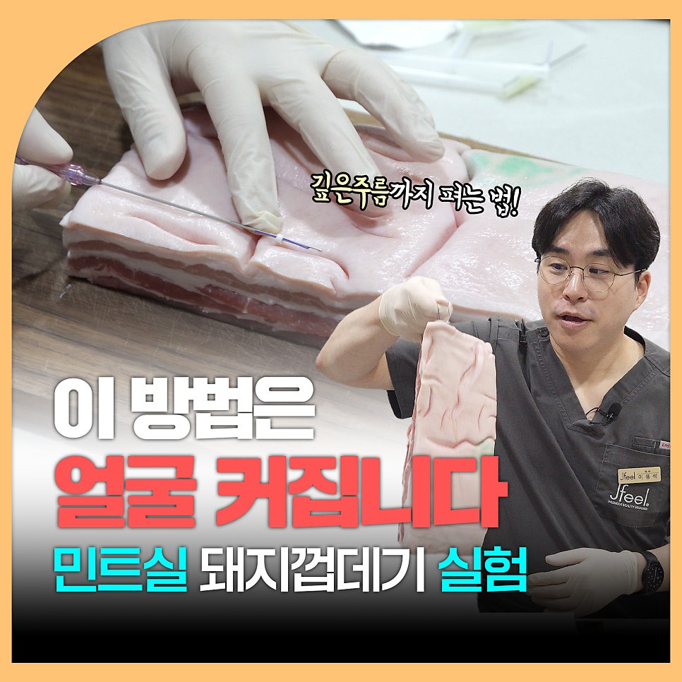 민트실을 돼지고기에 넣는다면? 실리프팅 실험 관련 이미지 1