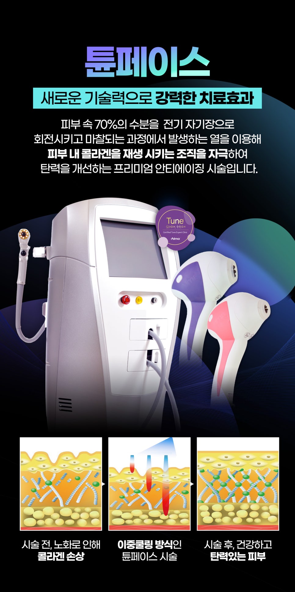 홍대튠페이스로 콜라겐 촉진과 지방 파괴 관련 이미지 4