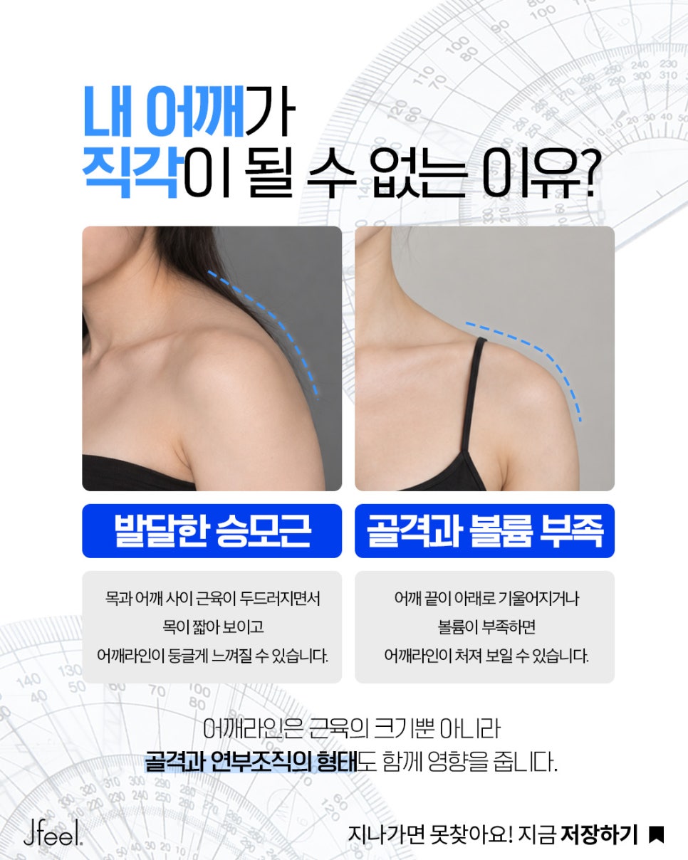 직각어깨 만드는 법, 승모근 보톡스 맞아도 안 되는 이유 관련 이미지 4