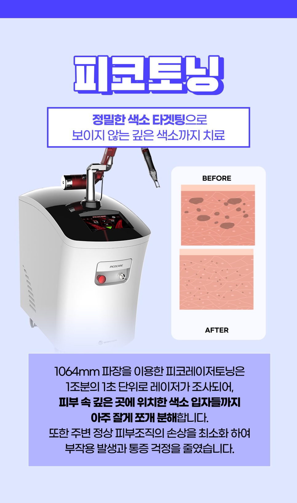 기미치료잘하는피부과에서 피부톤 UP 관련 이미지 3