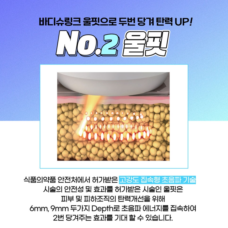 처지고 두꺼운 팔뚝살 고민? 이제는 안녕! 제이필 여리팔뚝 패키지 관련 이미지 3