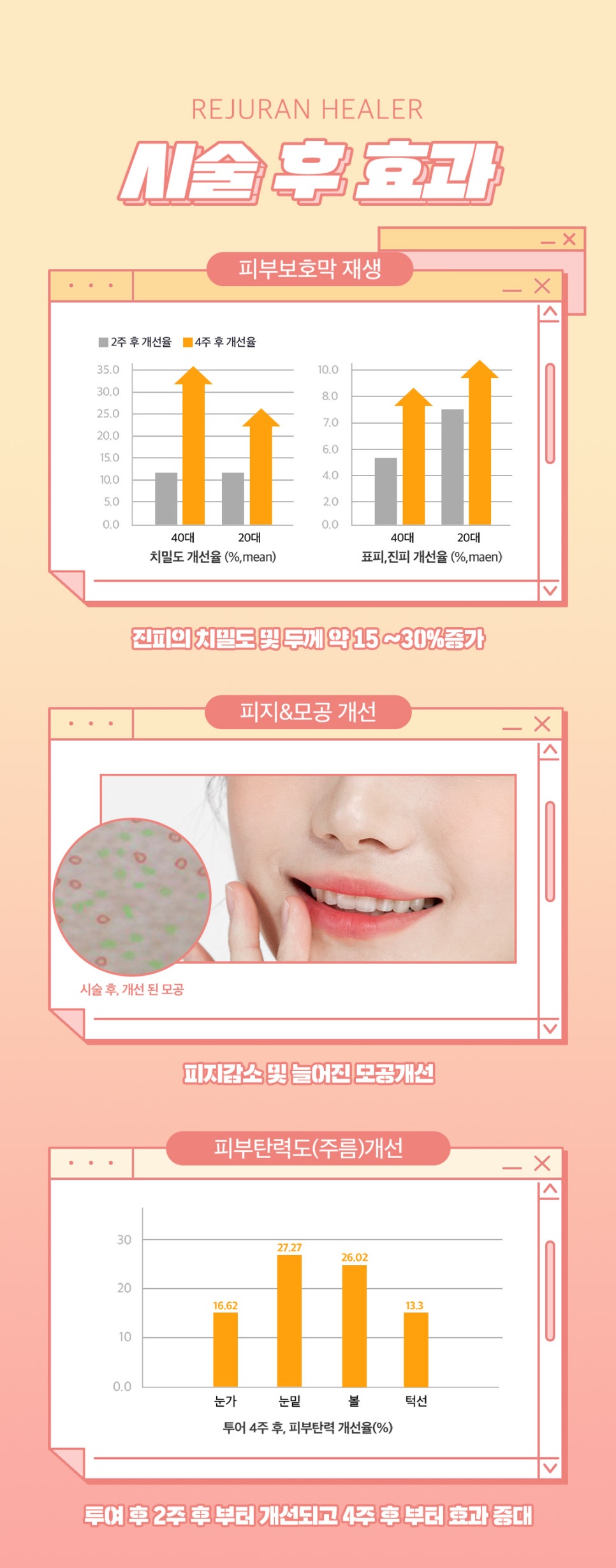 스킨부스터 리쥬란힐러로 피부 속부터 개선해요 관련 이미지 5