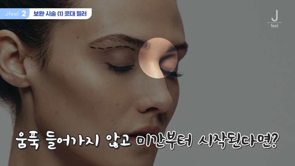 긴중안부를 커버할 수 있는 방법? 초간단 3가지! 관련 이미지 8
