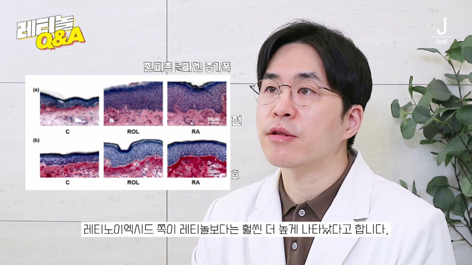 주름개선, 여드름 개선, 모공 개선 한방에 해결하는 법 📣최초 공개📣 레티놀 Q&A!! 관련 이미지 12