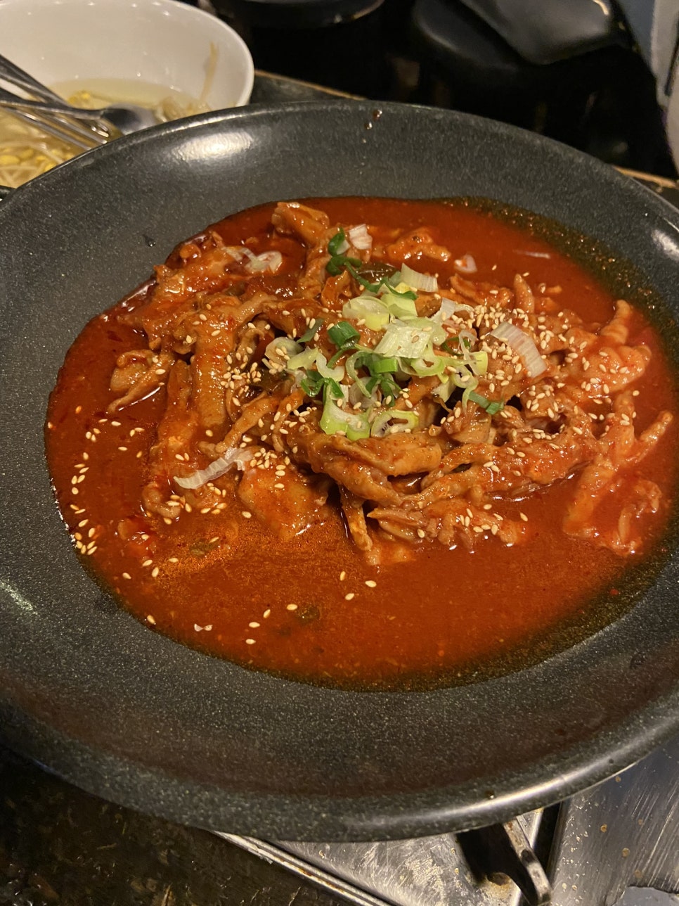 가로세로목주름 목주름필러시술로 20대부터 관리해보세요 관련 이미지 14