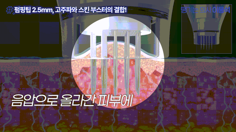 Hongdae Dermatology Pore Care: Why Your Pores Still Look the Same Even After Removing Sebum image 10