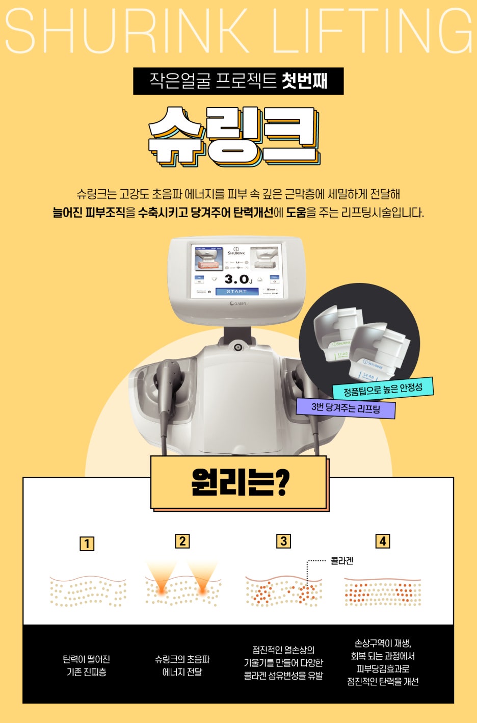 윤곽슈링크 슈링크+파워윤곽주사로 갸름하고 날렵하게 턱선관리 가능! 관련 이미지 3