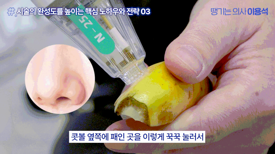 Hongdae Dermatology Pore Care: Why Your Pores Still Look the Same Even After Removing Sebum image 13