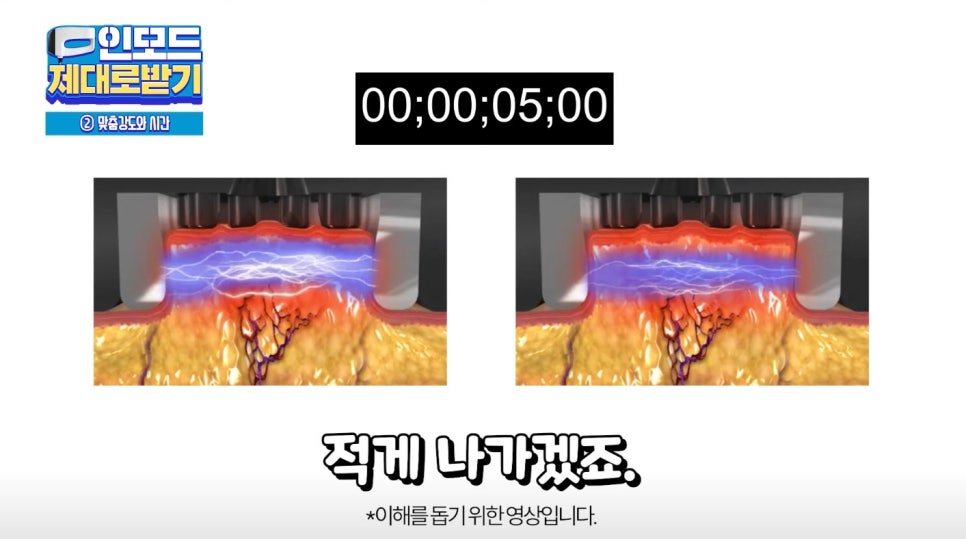 인모드효과 못 보셨다면 여기로 관련 이미지 22