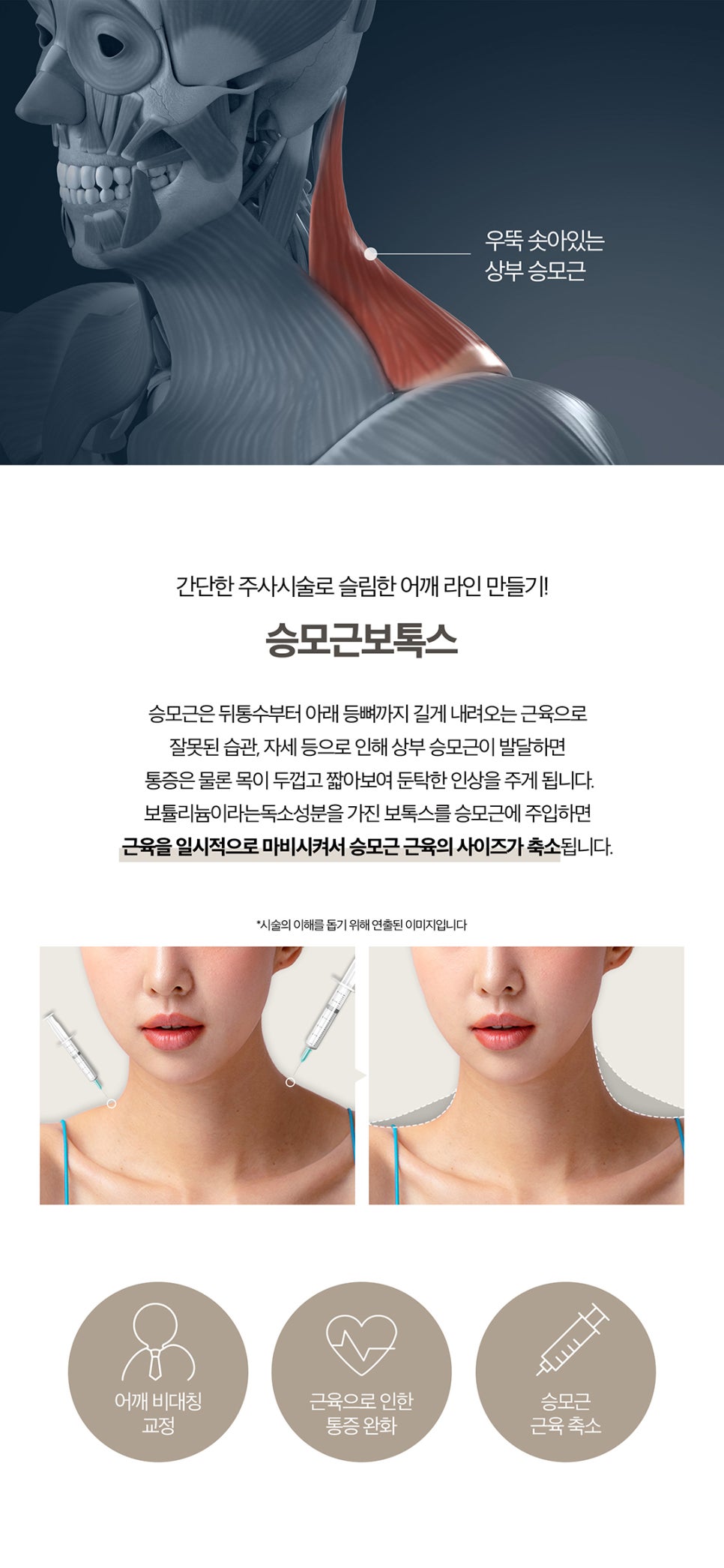 종아리관리는 종아리보톡스로 슬림 하게 관련 이미지 4
