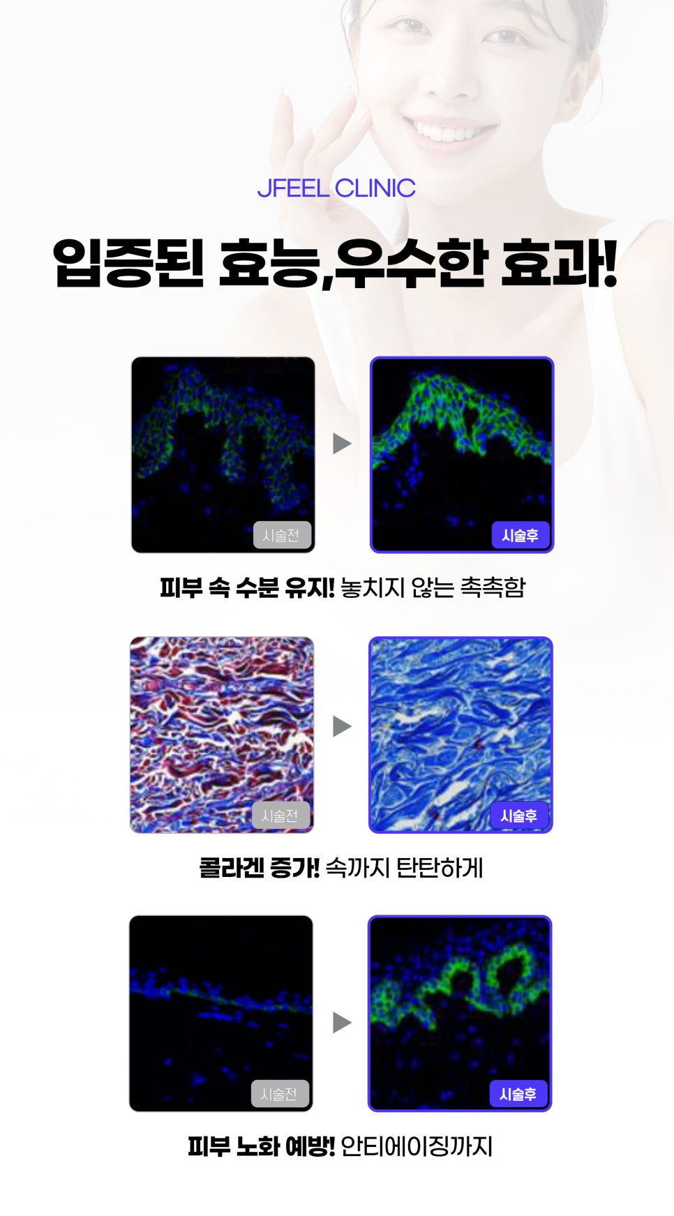 물광피부주사 릴리이드주사로 수분, 탄력 탄탄하게 관련 이미지 4
