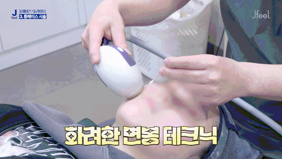 튠라이너 & 튠페이스 시술, 어떤 효과 있을까? 리프팅 + 탄력 관련 이미지 14