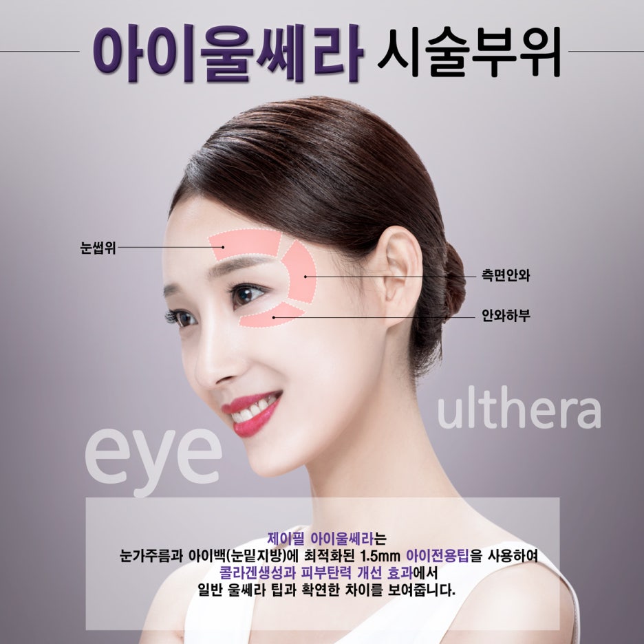 아이슈링크 아니고 정품 아이울쎄라! 관련 이미지 2