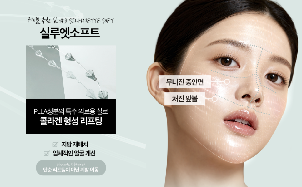 실리프팅 전문병원 선택 기준 총정리 ㅣ 실 종류&middot;디자인&middot;노하우&middot;의료진 경험 관련 이미지 15