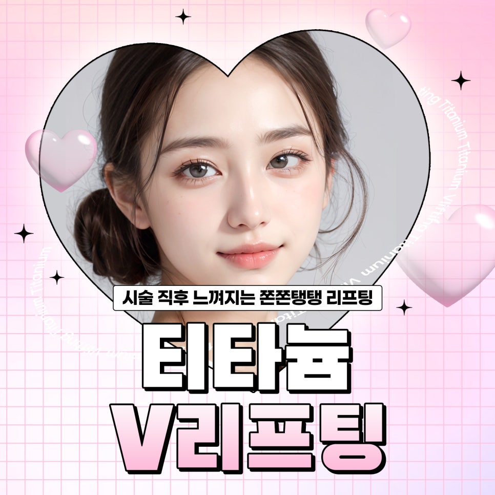 얼굴작아지는시술, 티타늄 V리프팅 관련 이미지 1