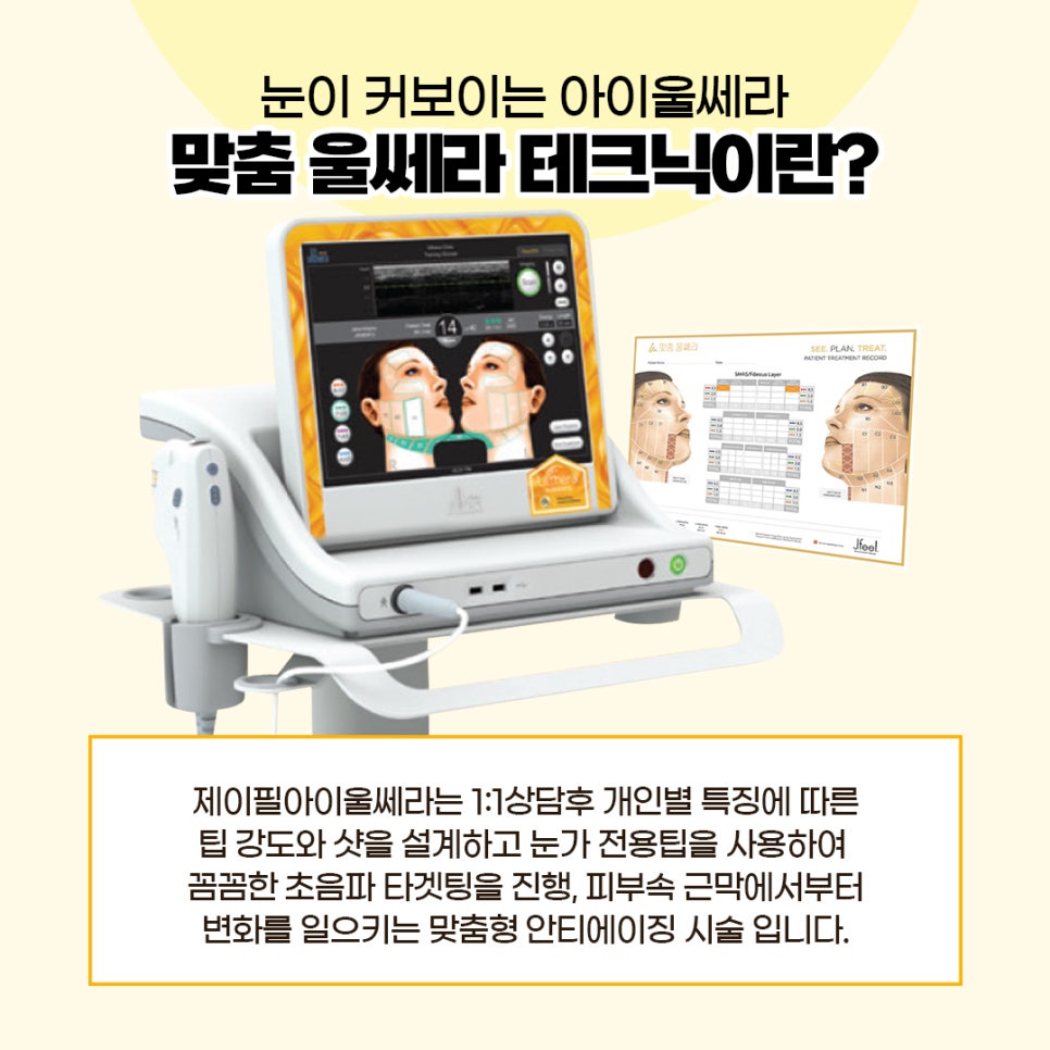 처진 눈가, 눈밑지방을 비수술하안검으로 또렷하고 선명하게 관련 이미지 2