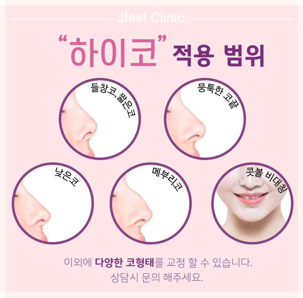 코필러, 하이코, 콧볼보톡스, 고양이코필러를 한번에! 관련 이미지 4