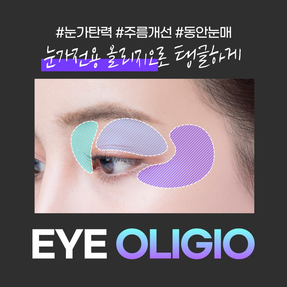 눈가주름탄력 개선에는 탱글리프팅 아이올리지오로 관련 이미지 2