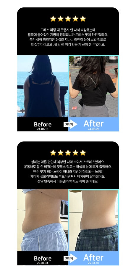 Fat That Won’t Go Away Even with Exercise, Solved with Fatduce Injection! Achieve a Slim Line Without Surgery! image 5
