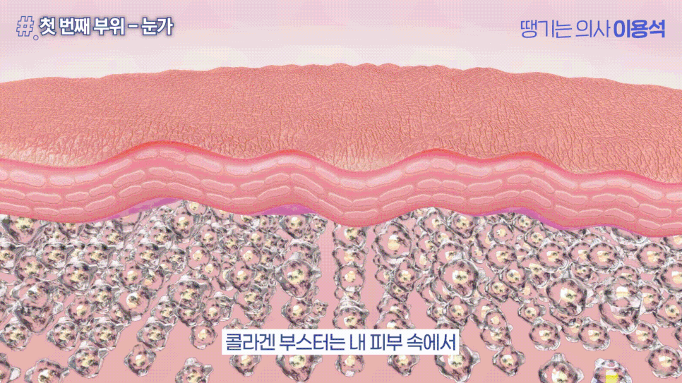 휴가 다녀왔더니 피부가 확 늙어 보인다? 여름철 피부관리 고우리 콜라겐부스터 관련 이미지 10