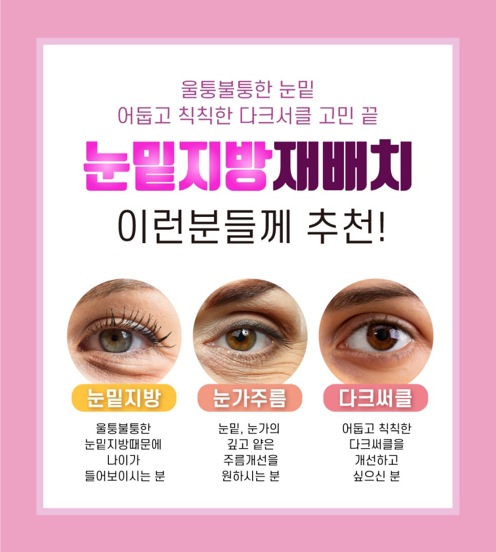 눈밑지방재배치 레이저 , 절개 없이 가능할까? 관련 이미지 5