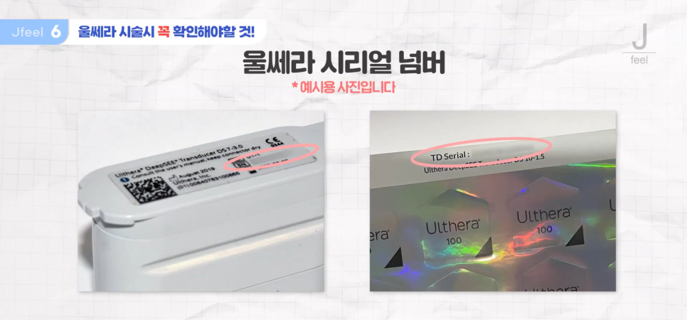 울쎄라샷수, 가성비 있게 예산 짜는 방법 대공개 관련 이미지 7