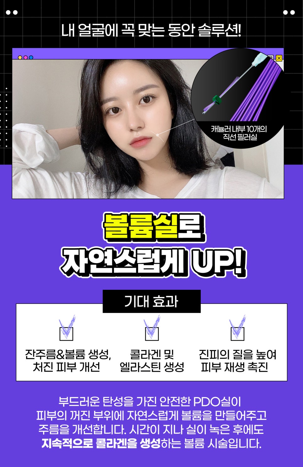 팔자주름없애는방법, 제이필 팽팽팔자주름으로 해결 관련 이미지 3