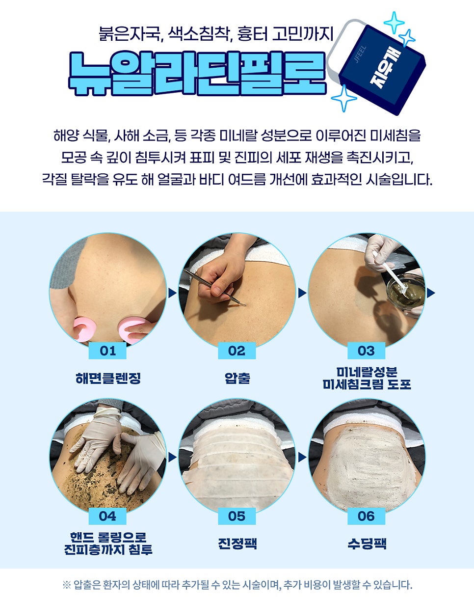 등드름, 가슴여드름 관리는 홍대피부과 뉴알라딘필링! 관련 이미지 3