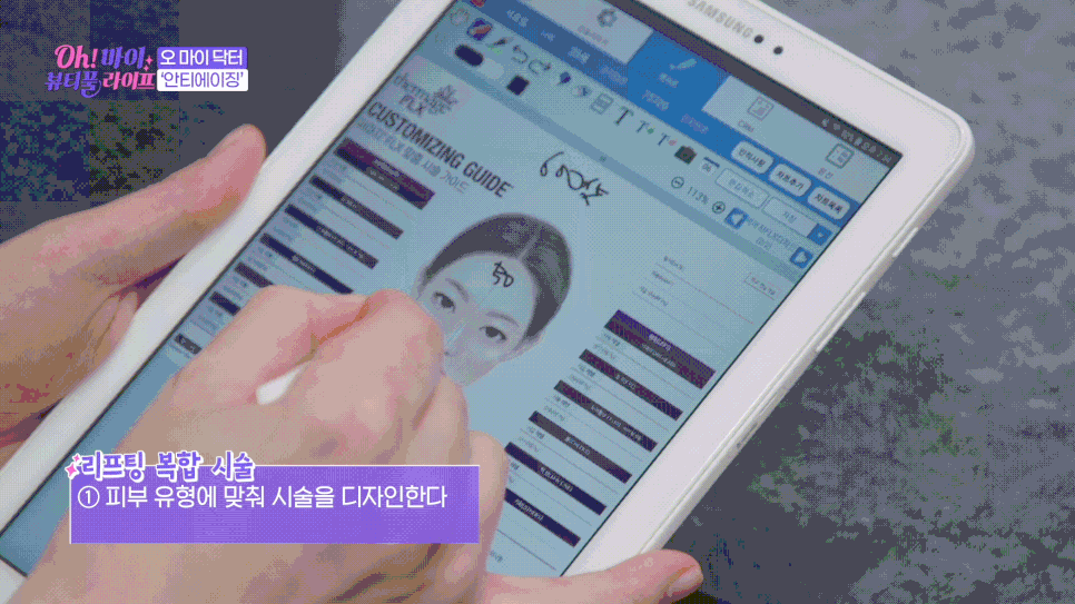 홍대 리프팅 추천! 연예인 서효림님도 받는 울써티(울쎄라,써마지,티타늄) 대공개 관련 이미지 15