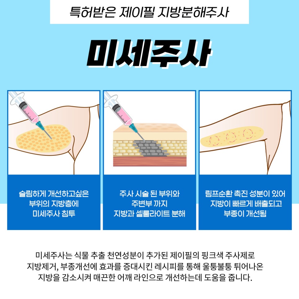 어깨라인 슬림 하게 만들고 싶다면 관련 이미지 5