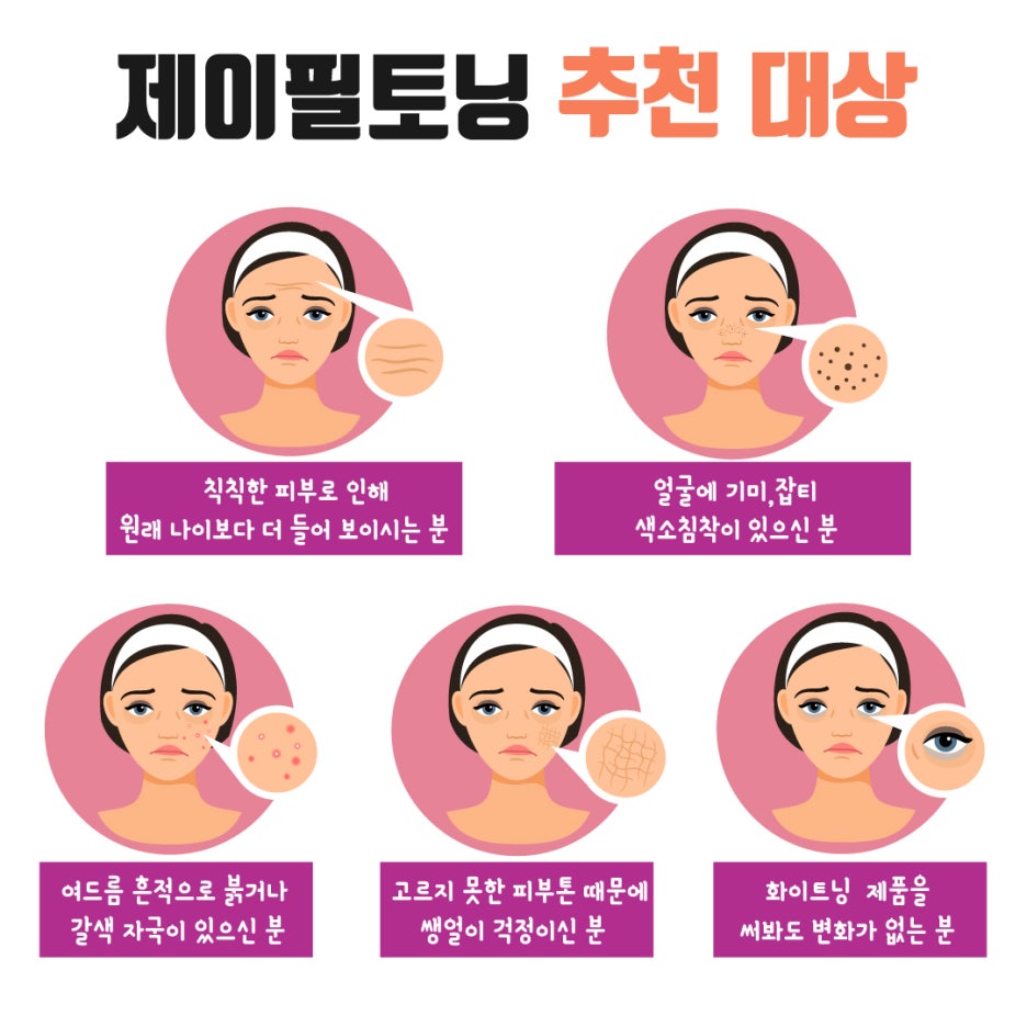 [홍대피부과] 제이필 레이저토닝-기미잡티제거는 제이필토닝으로 고민 해결! 관련 이미지 6