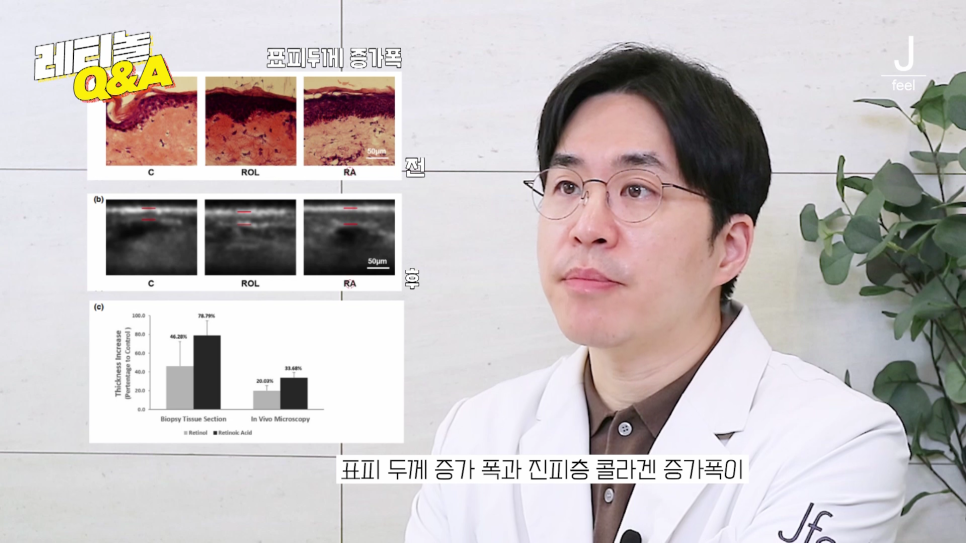 주름개선, 여드름 개선, 모공 개선 한방에 해결하는 법 📣최초 공개📣 레티놀 Q&A!! 관련 이미지 11