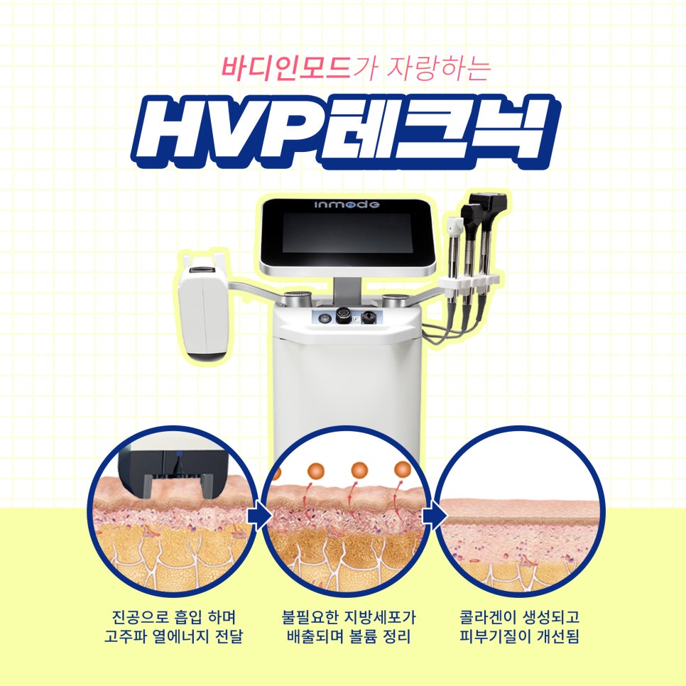 바디인모드효과 통증, 후기, 부작용 다 알려드립니다. 관련 이미지 2