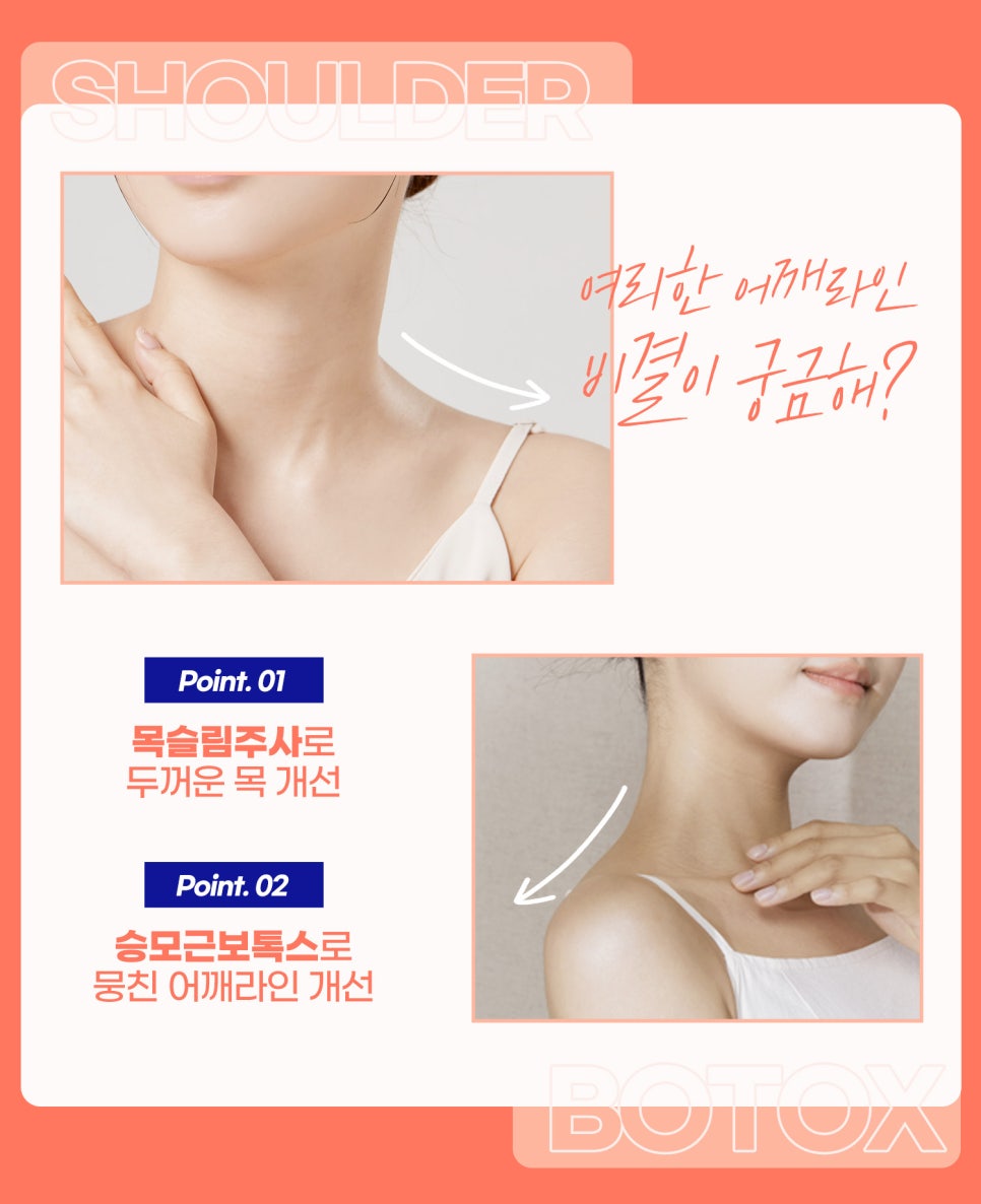 두꺼운목 고민이라면? 넥슬림주사와 승모근보톡스 관련 이미지 3