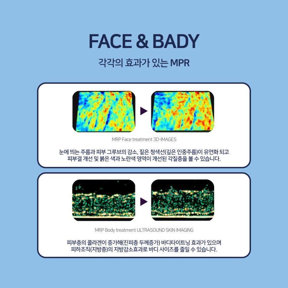 고주파마사지 바디땡김이로 바디리프팅과 지방분해 동시에! 관련 이미지 5