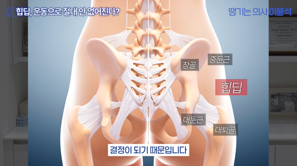Why Butt-Only Workouts Aren't Enough｜When Hip Fillers Are Needed for Hip Dips image 13