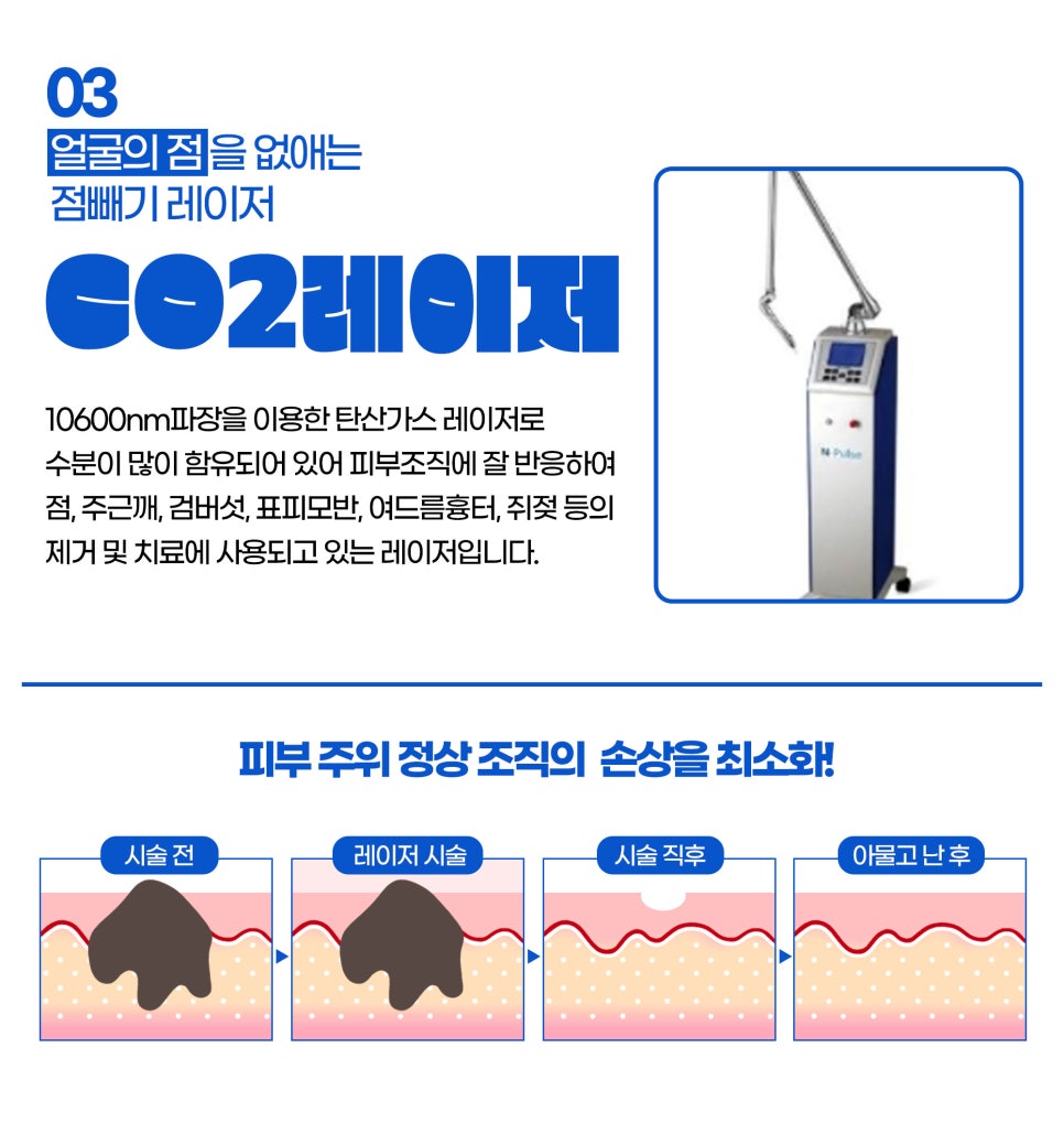 얼굴잡티관리, 원데이 잡티지우개로 확실하게 관련 이미지 5