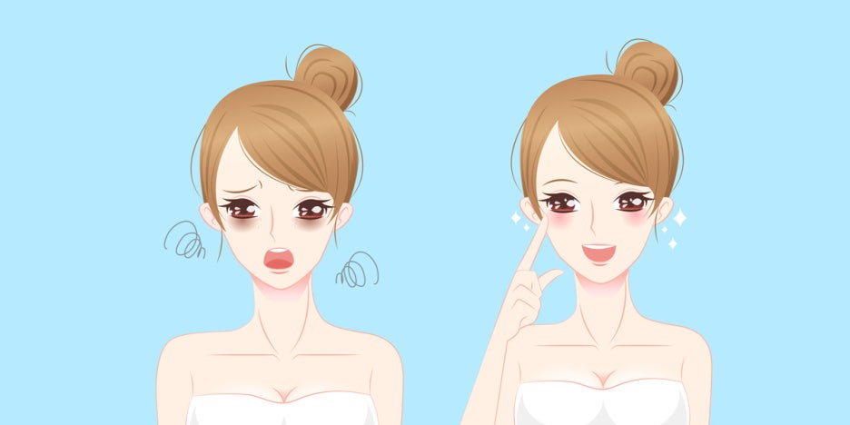 아이슈링크 아니고 정품 아이울쎄라! 관련 이미지 4